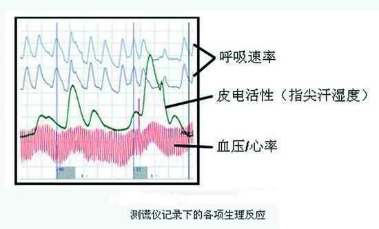 测谎仪心理条形图.jpg